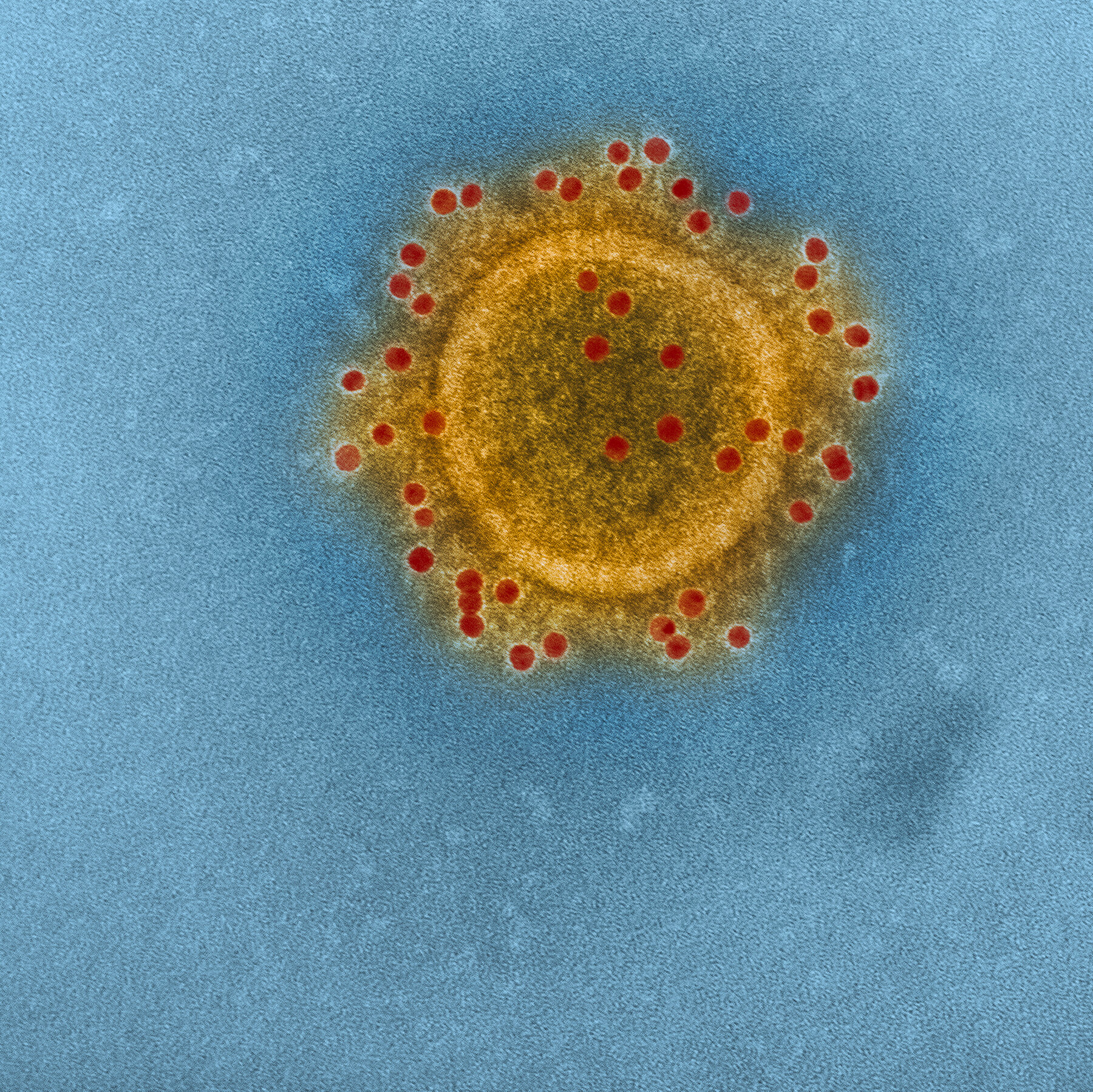 Why efforts to make better, more universal coronavirus vaccines are struggling